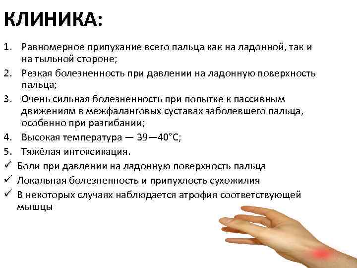 КЛИНИКА: 1. Равномерное припухание всего пальца как на ладонной, так и на тыльной стороне;