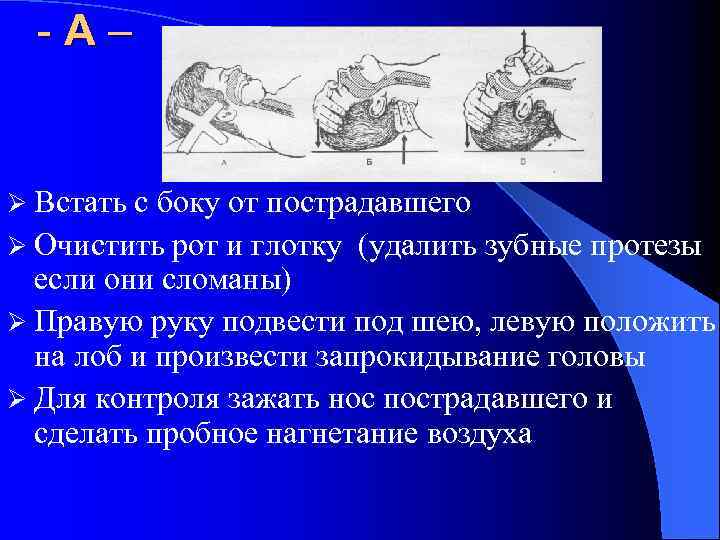 -А– Ø Встать с боку от пострадавшего Ø Очистить рот и глотку (удалить зубные