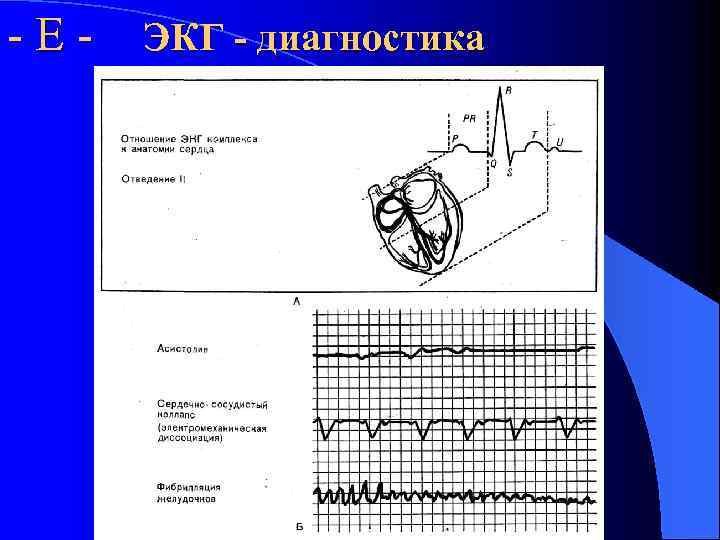 - Е - ЭКГ - диагностика 