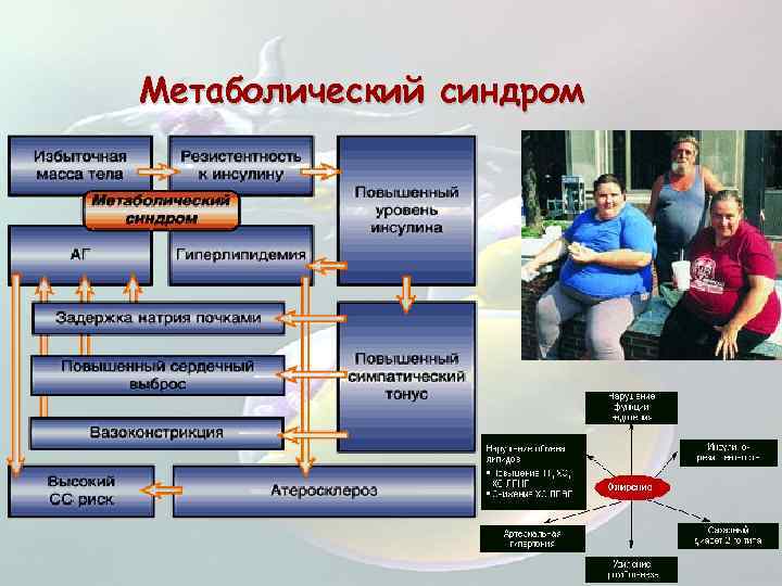 Метаболический синдром 