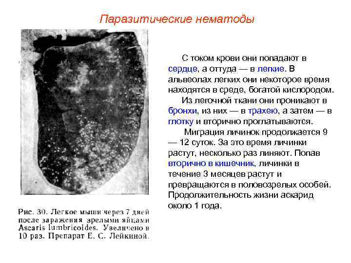 Паразитические нематоды С током крови они попадают в сердце, а оттуда — в легкие.