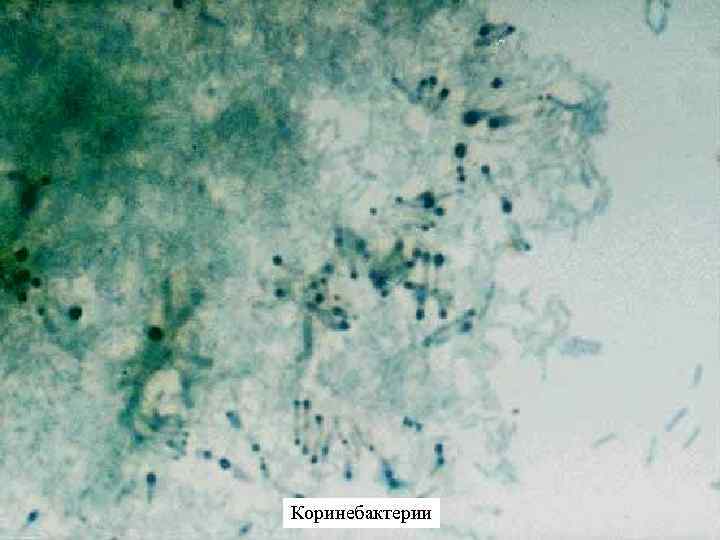 Коринебактерии 