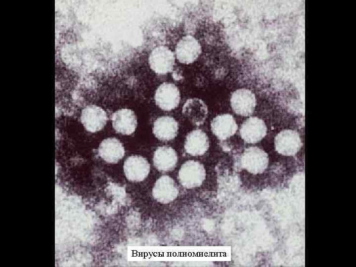 Вирусы полиомиелита 