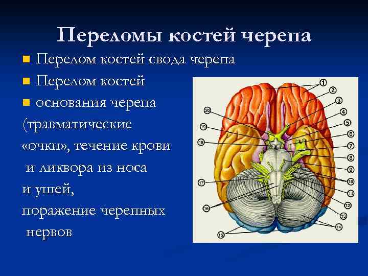 Переломы костей черепа Перелом костей свода черепа n Перелом костей n основания черепа (травматические
