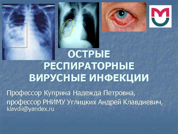 ОСТРЫЕ РЕСПИРАТОРНЫЕ ВИРУСНЫЕ ИНФЕКЦИИ Профессор Куприна Надежда Петровна, профессор РНИМУ Углицких Андрей Клавдиевич, klavdii@yandex.