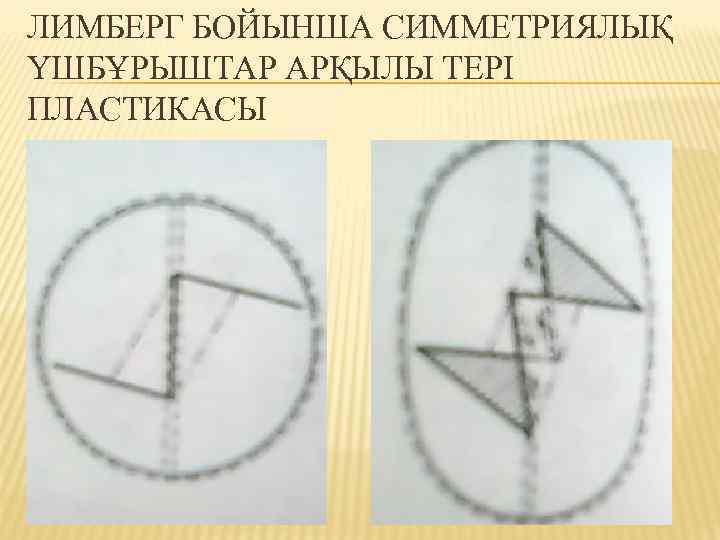 ЛИМБЕРГ БОЙЫНША СИММЕТРИЯЛЫҚ ҮШБҰРЫШТАР АРҚЫЛЫ ТЕРІ ПЛАСТИКАСЫ 