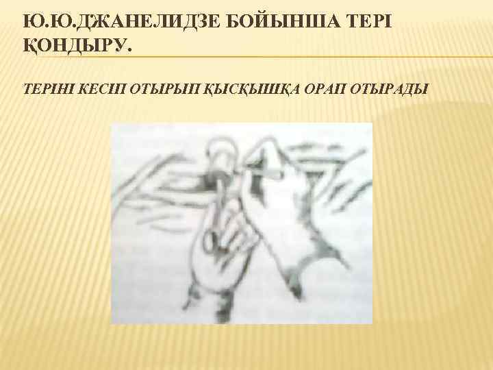 Ю. Ю. ДЖАНЕЛИДЗЕ БОЙЫНША ТЕРІ ҚОНДЫРУ. ТЕРІНІ КЕСІП ОТЫРЫП ҚЫСҚЫШҚА ОРАП ОТЫРАДЫ 