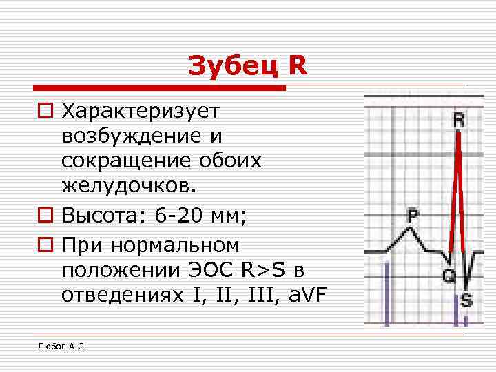 Зубец R o Характеризует возбуждение и сокращение обоих желудочков. o Высота: 6 -20 мм;