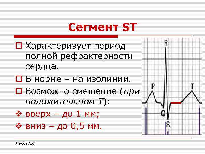 Сегмент ST o Характеризует период полной рефрактерности сердца. o В норме – на изолинии.