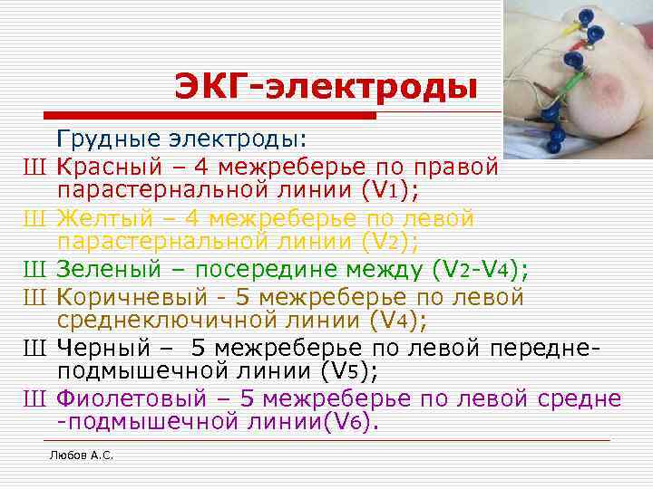 ЭКГ-электроды Ш Ш Ш Грудные электроды: Красный – 4 межреберье по правой парастернальной линии