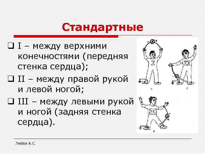 Стандартные q I – между верхними конечностями (передняя стенка сердца); q II – между