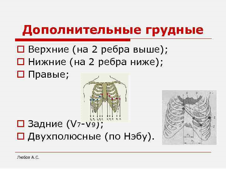 Дополнительные грудные o Верхние (на 2 ребра выше); o Нижние (на 2 ребра ниже);