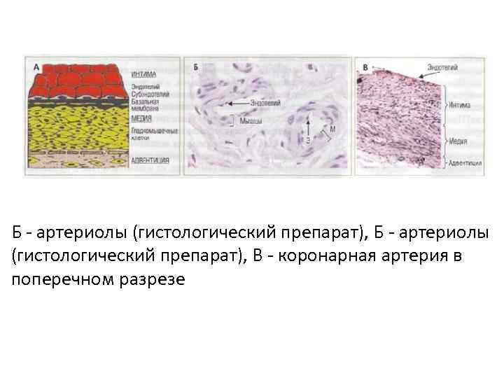 Б артериолы (гистологический препарат), В коронарная артерия в поперечном разрезе 