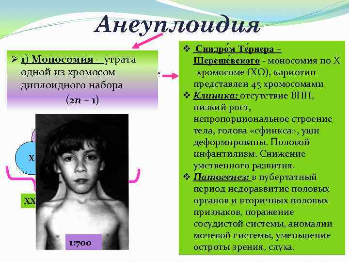 Анеуплоидия Ø 1) Моносомия – утрата Причина: Ø одной из хромосом не расхождение в