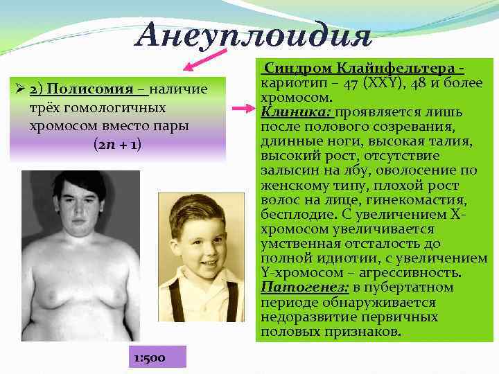 Анеуплоидия Ø 2) Полисомия – наличие трёх гомологичных хромосом вместо пары (2 n +