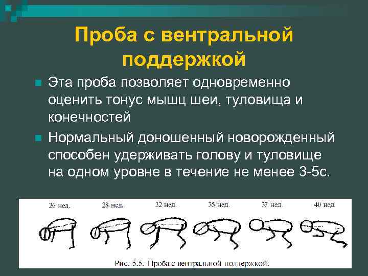 Проба с вентральной поддержкой n n Эта проба позволяет одновременно оценить тонус мышц шеи,