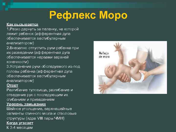 Рефлекс Моро Как вызывается 1. Резко дернуть за пеленку, на которой лежит ребенок (афферентная