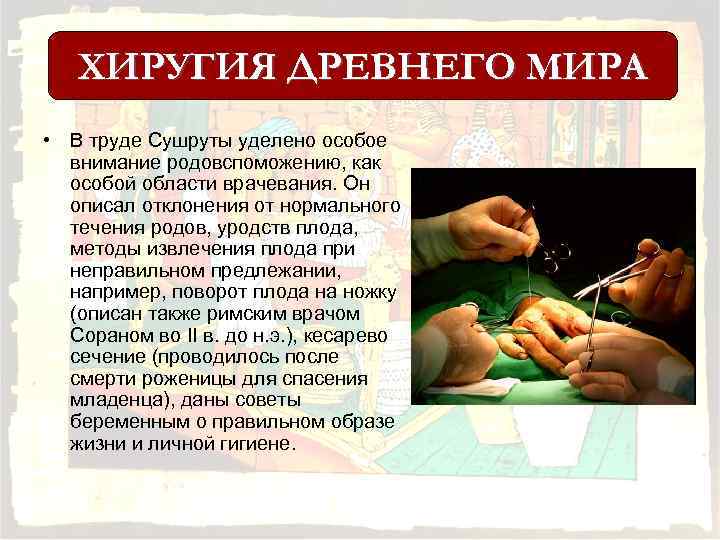 ХИРУГИЯ ДРЕВНЕГО МИРА • В труде Сушруты уделено особое внимание родовспоможению, как особой области