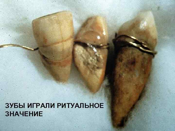 ЗУБЫ ИГРАЛИ РИТУАЛЬНОЕ ЗНАЧЕНИЕ 