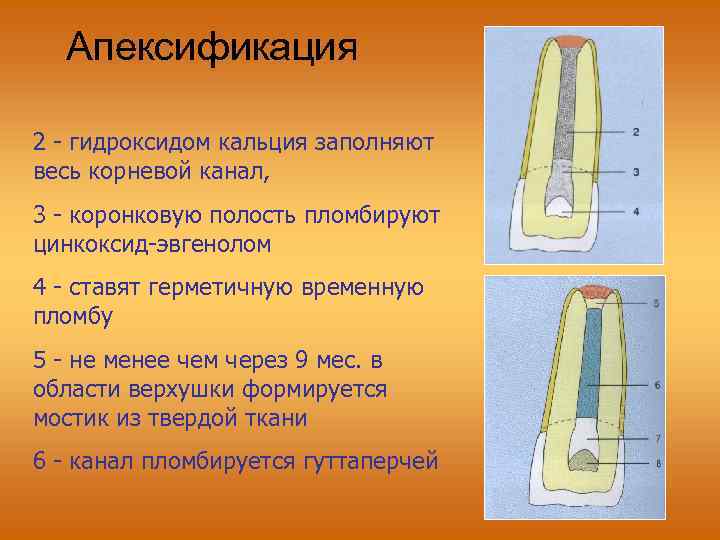 Апексогенез и апексификация презентация