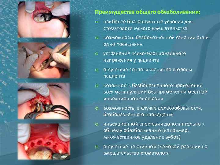 Преимущества общего обезболивания: o наиболее благоприятные условия для стоматологического вмешательства o возможность безболезненной санации