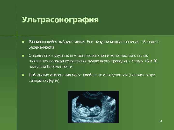 Ультрасонография n Развивающийся эмбрион может быт визуализирован начиная с 6 недель беременности n Определение