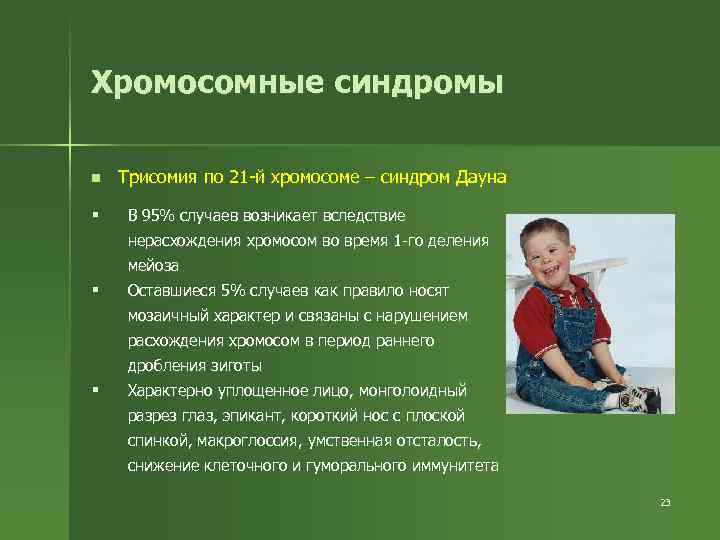 Хромосомные синдромы n § Трисомия по 21 -й хромосоме – синдром Дауна В 95%