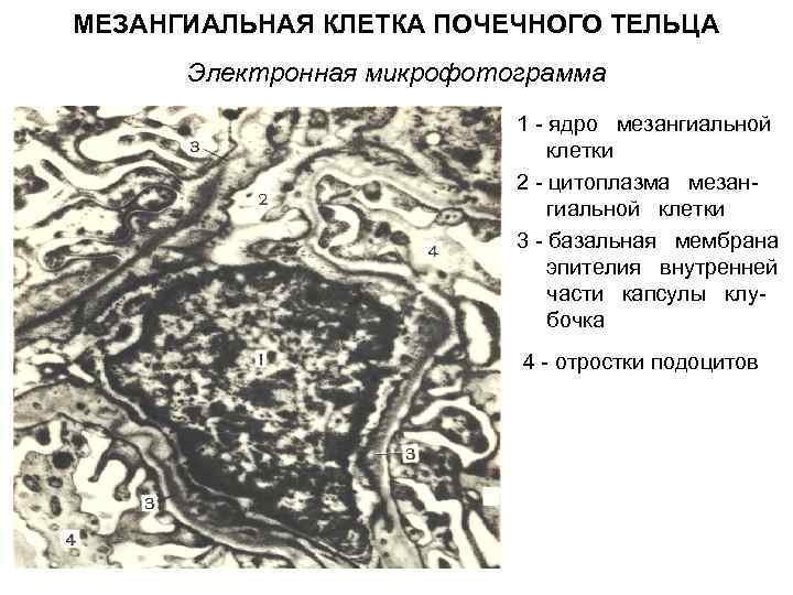 МЕЗАНГИАЛЬНАЯ КЛЕТКА ПОЧЕЧНОГО ТЕЛЬЦА Электронная микрофотограмма 1 ядро мезангиальной клетки 2 цитоплазма мезан гиальной