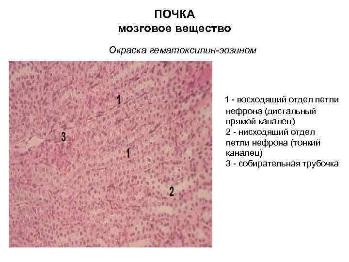 ПОЧКА мозговое вещество Окраска гематоксилин-эозином 1 восходящий отдел петли нефрона (дистальный прямой каналец) 2