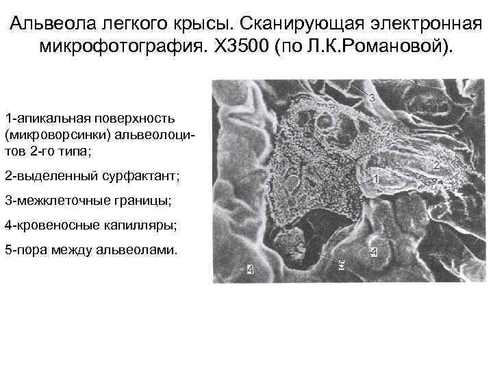 Альвеола легкого крысы. Сканирующая электронная микрофотография. Х 3500 (по Л. К. Романовой). 1 -апикальная