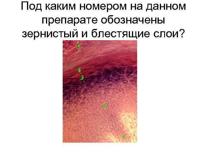 Под каким номером на данном препарате обозначены зернистый и блестящие слои? 