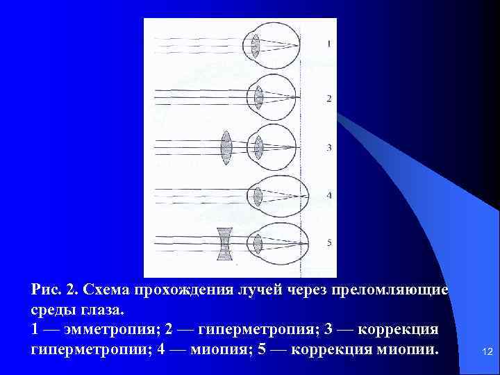 Ход лучей света через глаз схема