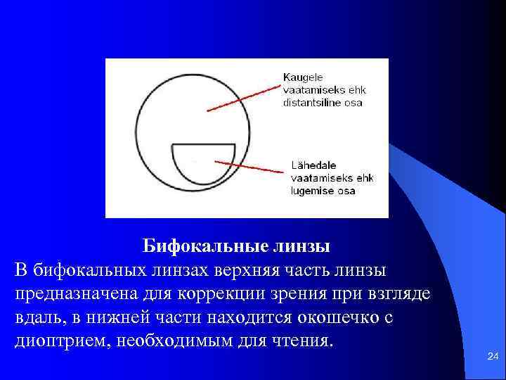 Бифокальные линзы В бифокальных линзах верхняя часть линзы предназначена для коррекции зрения при взгляде