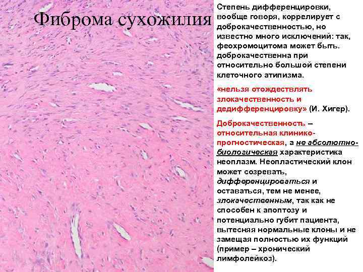 Фиброма сухожилия Степень дифференцировки, вообще говоря, коррелирует с доброкачественностью, но известно много исключений: так,