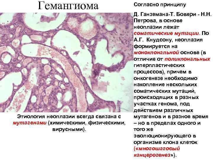 Гемангиома Этиология неоплазии всегда связана с мутагенами (химическими, физическими, вирусными). Согласно принципу Д. Ганземана-Т.