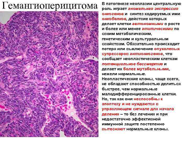 Гемангиоперицитома В патогенезе неоплазии центральную роль играет аномальная экспрессия онкогенов и синтез кодируемых ими