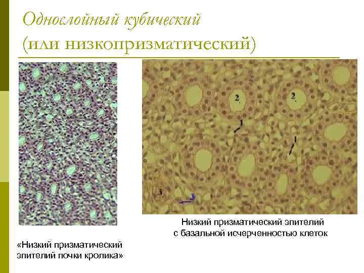 Однослойный кубический (или низкопризматический) Низкий призматический эпителий с базальной исчерченностью клеток «Низкий призматический эпителий