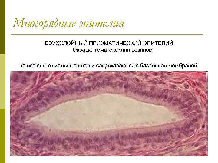 Многорядные эпителии ДВУХСЛОЙНЫЙ ПРИЗМАТИЧЕСКИЙ ЭПИТЕЛИЙ Окраска гематоксилин-эозином не все эпителиальные клетки соприкасаются с базальной