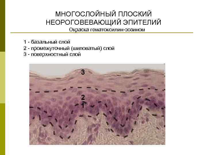 МНОГОСЛОЙНЫЙ ПЛОСКИЙ НЕОРОГОВЕВАЮЩИЙ ЭПИТЕЛИЙ Окраска гематоксилин-эозином 1 - базальный слой 2 - промежуточный (шиповатый)