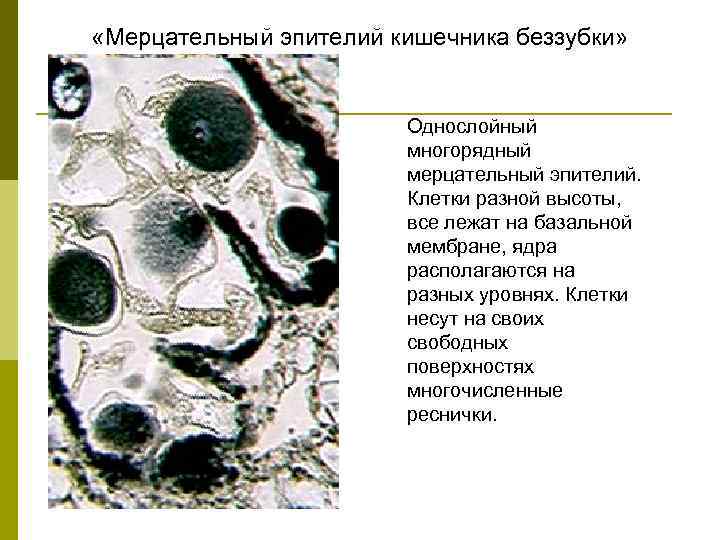  «Мерцательный эпителий кишечника беззубки» Однослойный многорядный мерцательный эпителий. Клетки разной высоты, все лежат
