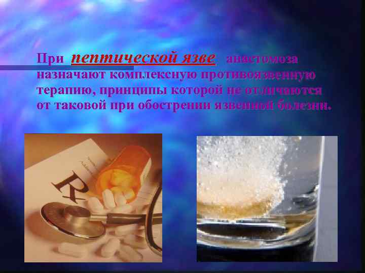 При пептической язве анастомоза назначают комплексную противоязвенную терапию, принципы которой не отличаются от таковой