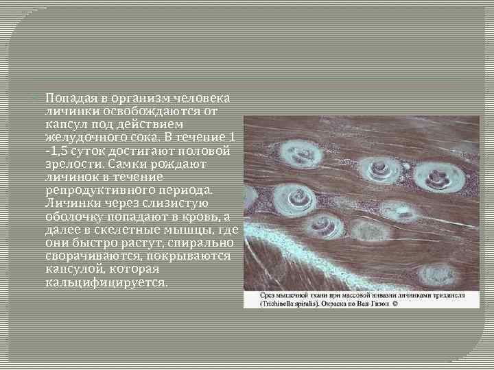  Попадая в организм человека личинки освобождаются от капсул под действием желудочного сока. В