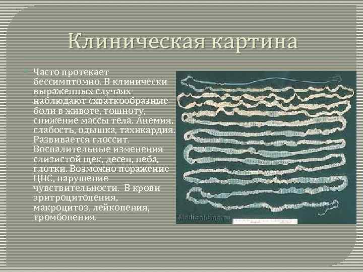 Клиническая картина Часто протекает бессимптомно. В клинически выраженных случаях наблюдают схваткообразные боли в животе,