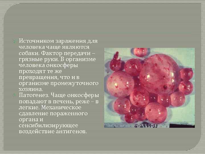  Источником заражения для человека чаще являются собаки. Фактор передачи – грязные руки. В