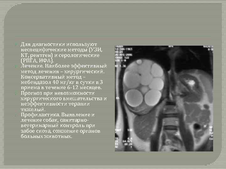 Для диагностики используют неспецифические методы (УЗИ, КТ, рентген) и серологические (РПГА, ИФА). Лечение.
