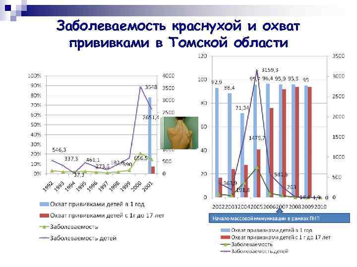Заболеваемость краснухой и охват прививками в Томской области 