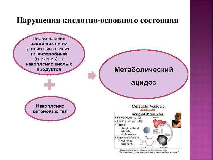 Нарушения кислотно-основного состояния Переключение аэробных путей утилизации глюкозы на анаэробный (гликолиз) → накопление кислых