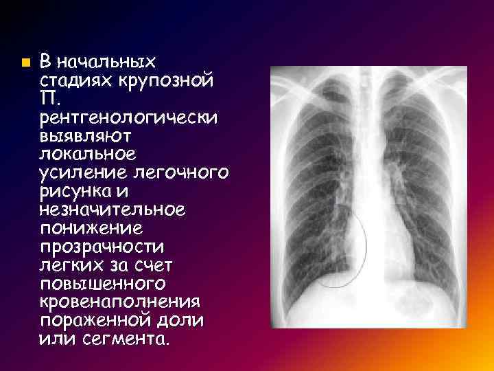 n В начальных стадиях крупозной П. рентгенологически выявляют локальное усиление легочного рисунка и незначительное