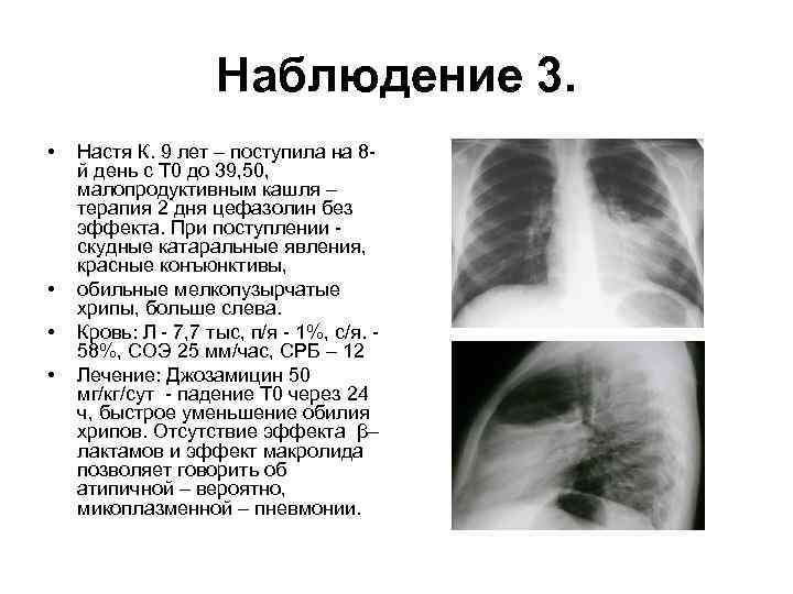Наблюдение 3. • • Настя К. 9 лет – поступила на 8 й день