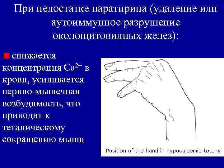 При недостатке паратирина (удаление или аутоиммунное разрушение околощитовидных желез): снижается концентрация Са 2+ в